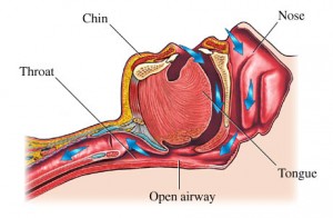 Airway management