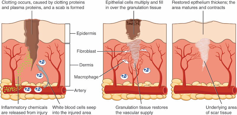 Tissue Repair Diagram